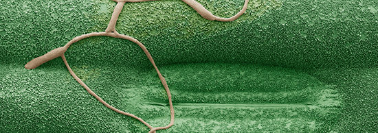 Septoria Microscopy Syngenta Elatus Era